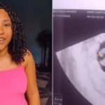 Jovem de 18 anos descobre gravidez de quíntuplos e passa mal no RJ